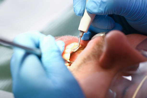 Best Emergency Dental Care for Broken or Chipped Teeth in , KS