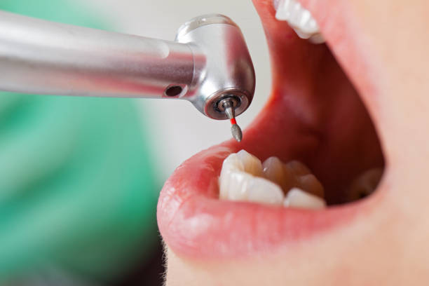 Best Emergency Treatment for Dental Infections or Abscesses in , KS
